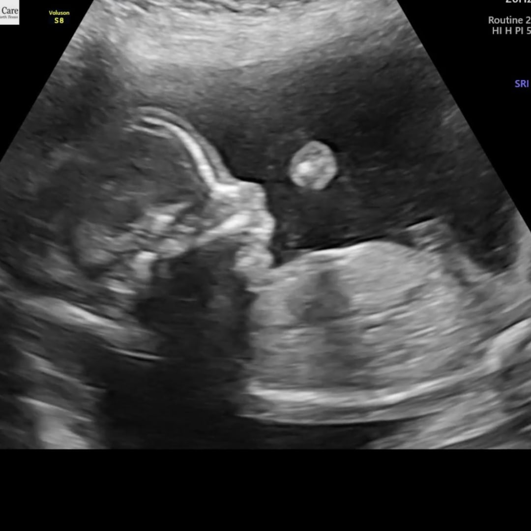Photo shared by Deysi for their Babylist baby registry.