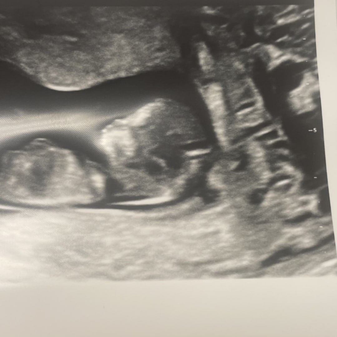 Photo shared by Elaina for their Babylist baby registry.