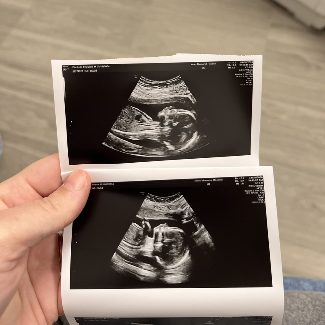 Photo shared by Cheyene for their Babylist baby registry.