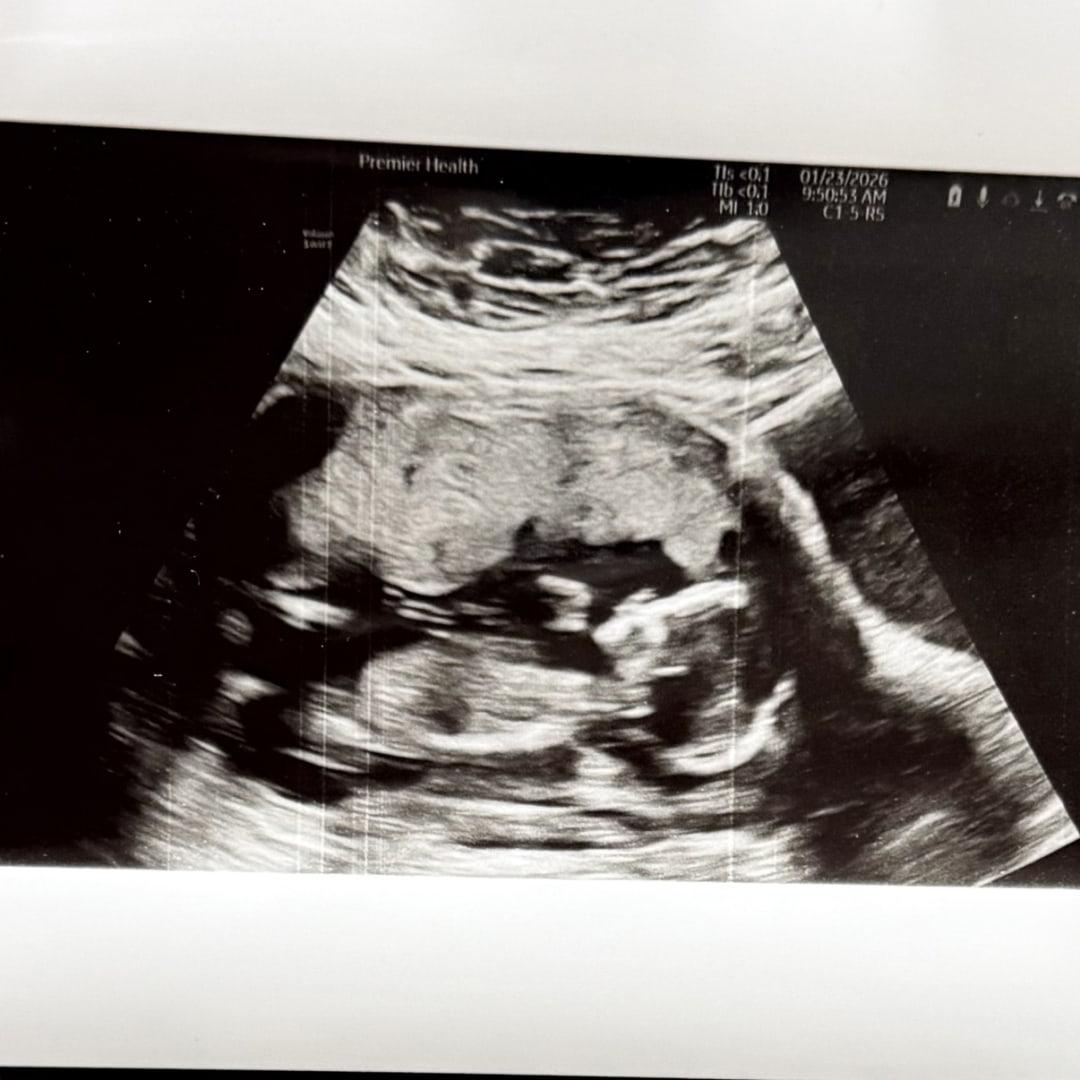 Photo shared by Hannah for their Babylist baby registry.