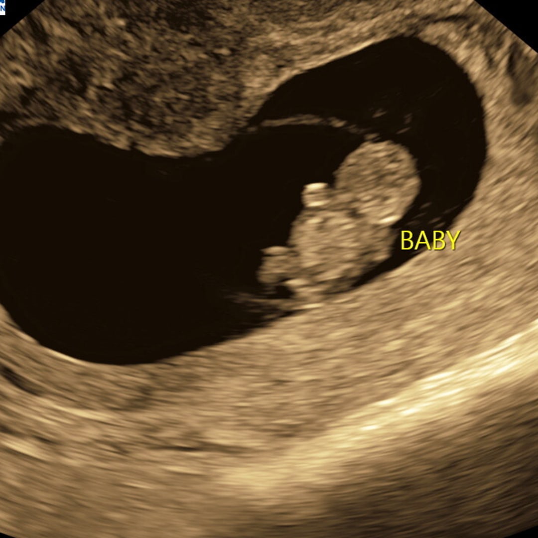 Photo shared by Megan for their Babylist baby registry.