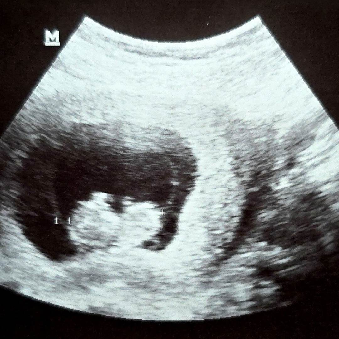 Photo shared by Brittany for their Babylist baby registry.