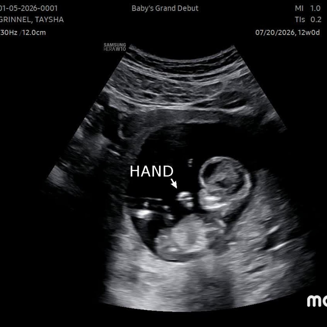 Photo shared by Taysha for their Babylist baby registry.