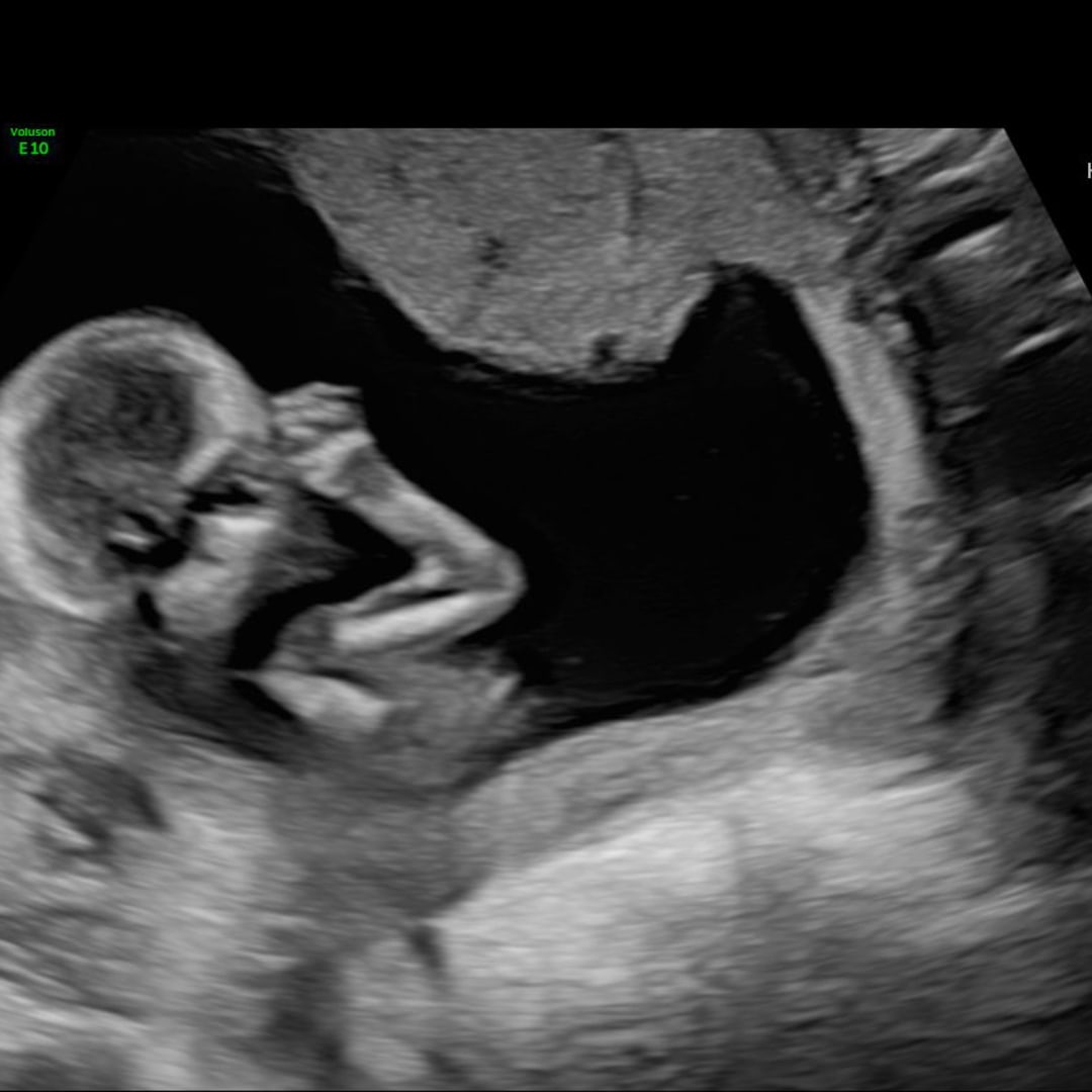 Photo shared by Auralila for their Babylist baby registry.