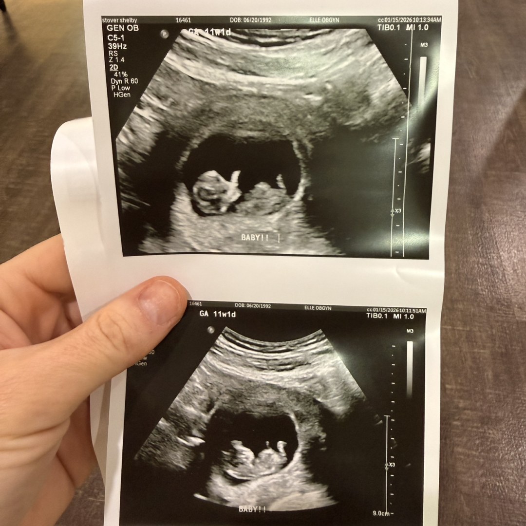 Photo shared by Shelby for their Babylist baby registry.