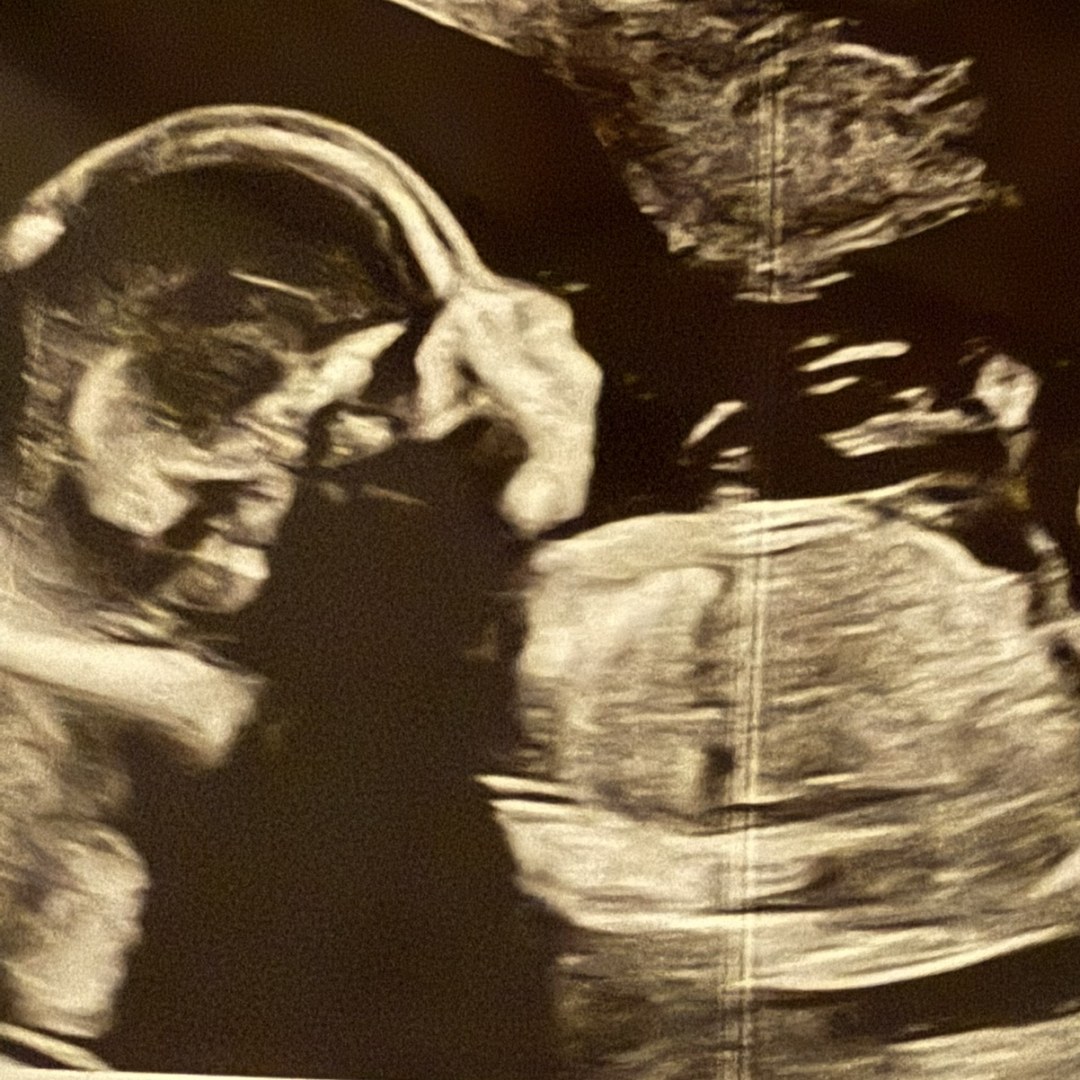 Photo shared by Ashlynn for their Babylist baby registry.