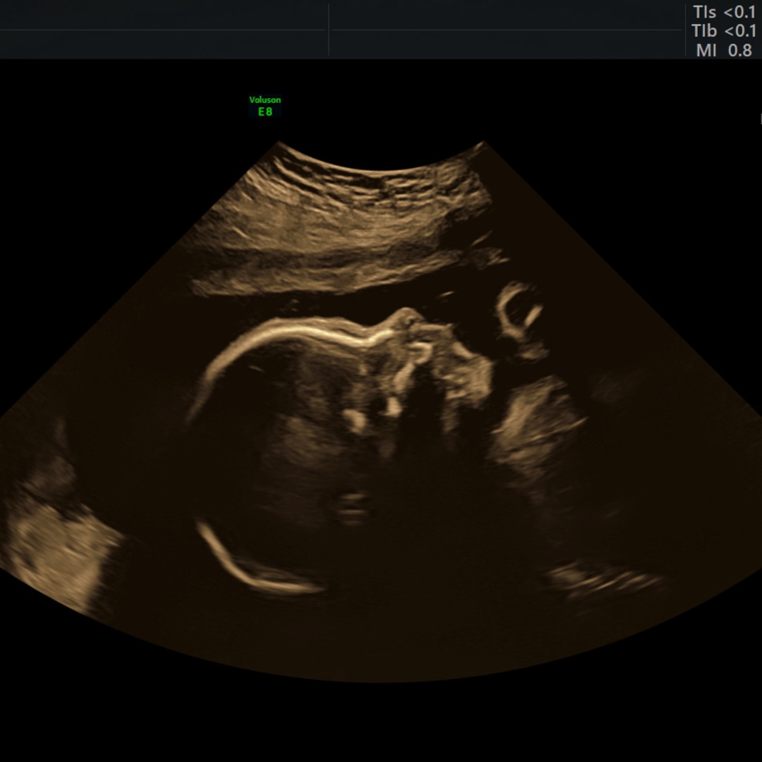 Photo shared by Alexa for their Babylist baby registry.
