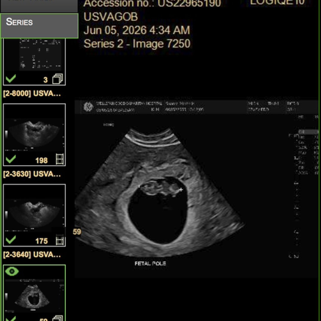 Photo shared by Marbelis for their Babylist baby registry.