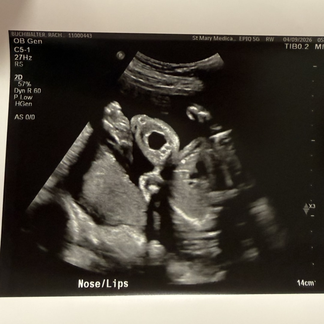 Photo shared by Rachel for their Babylist baby registry.