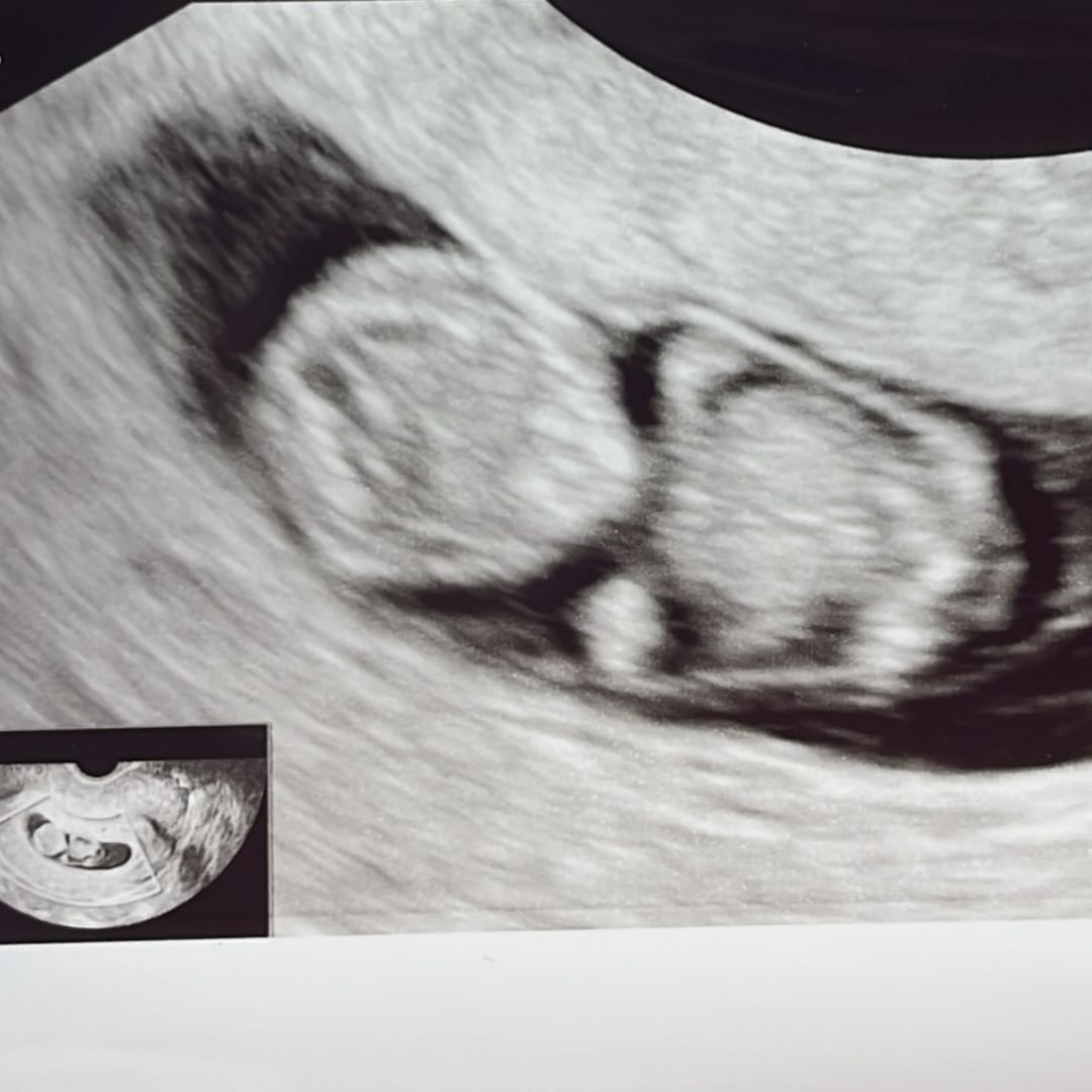 Photo shared by Lenny for their Babylist baby registry.