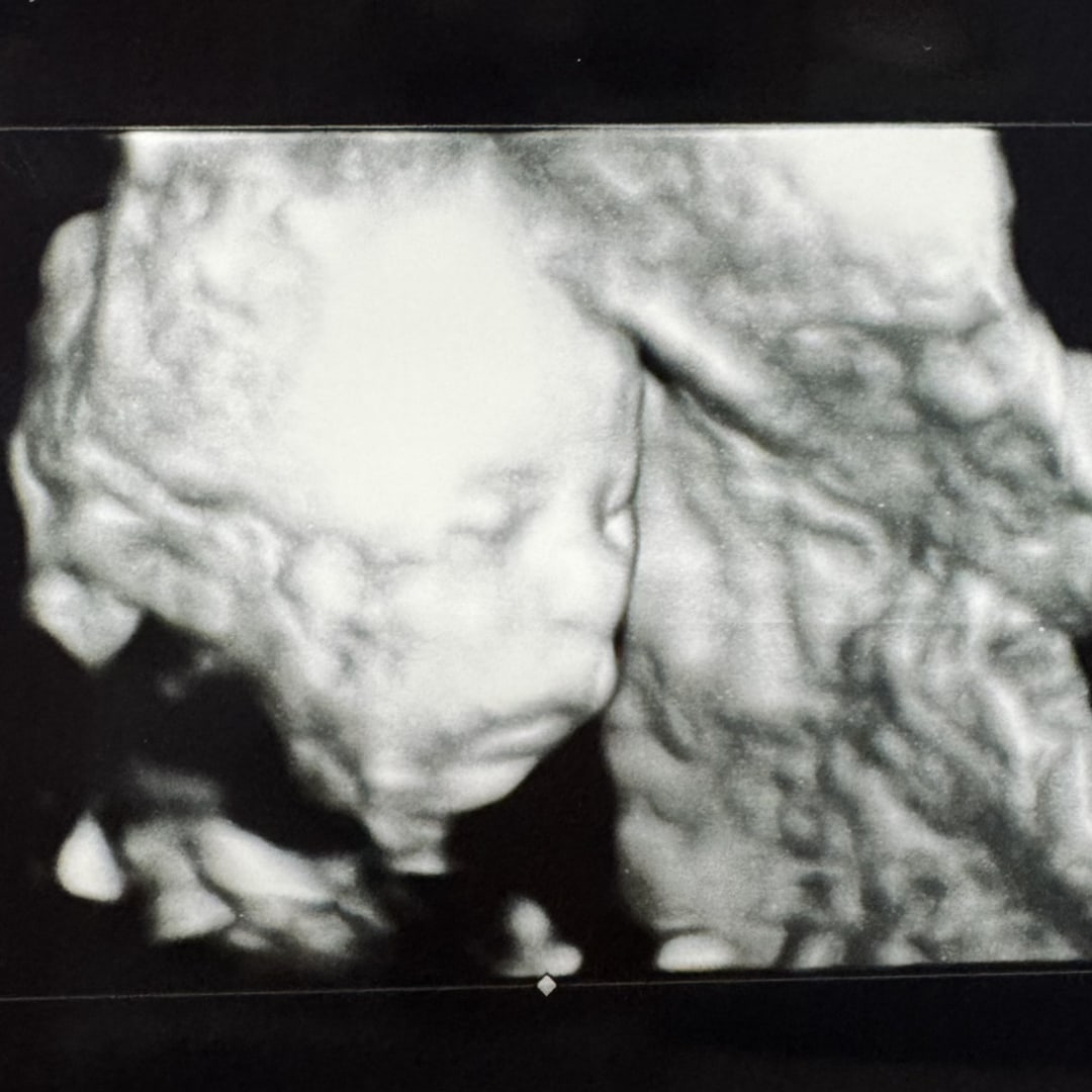 Photo shared by Giselle for their Babylist baby registry.