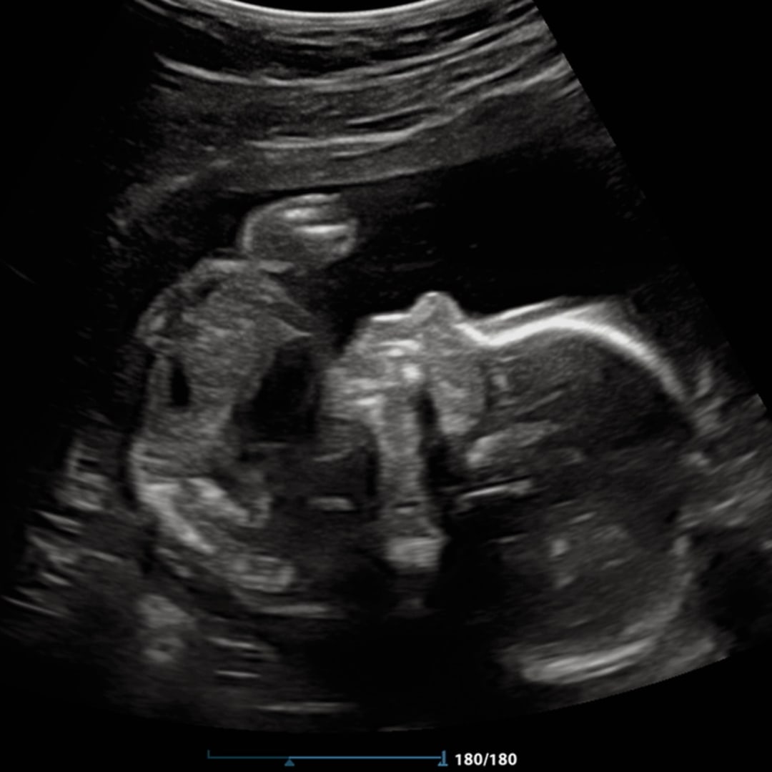 Photo shared by Madilyn for their Babylist baby registry.