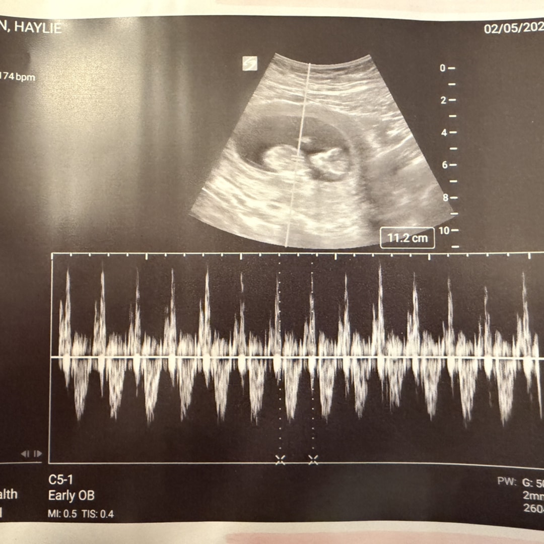 Photo shared by Haylie for their Babylist baby registry.