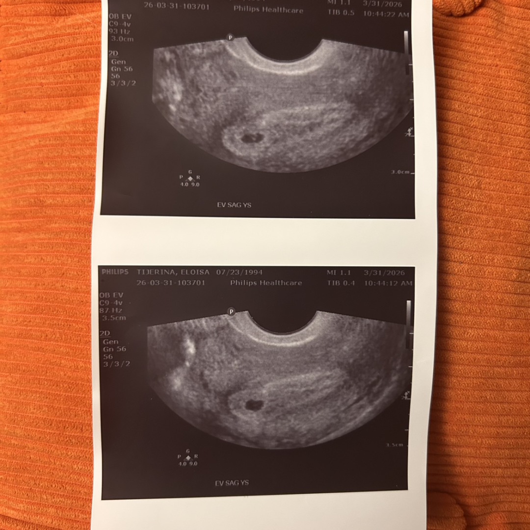 Photo shared by Eloisa for their Babylist baby registry.