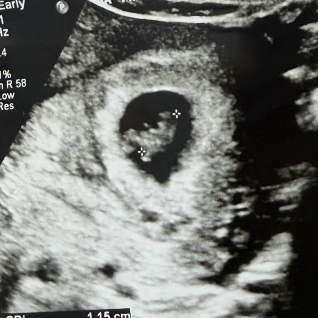 Photo shared by Ari for their Babylist baby registry.