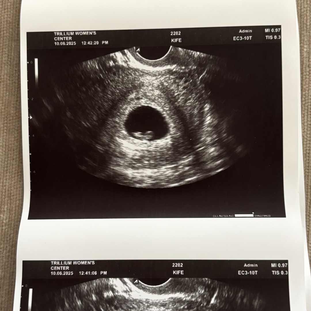 Photo shared by Kimberlee for their Babylist baby registry.