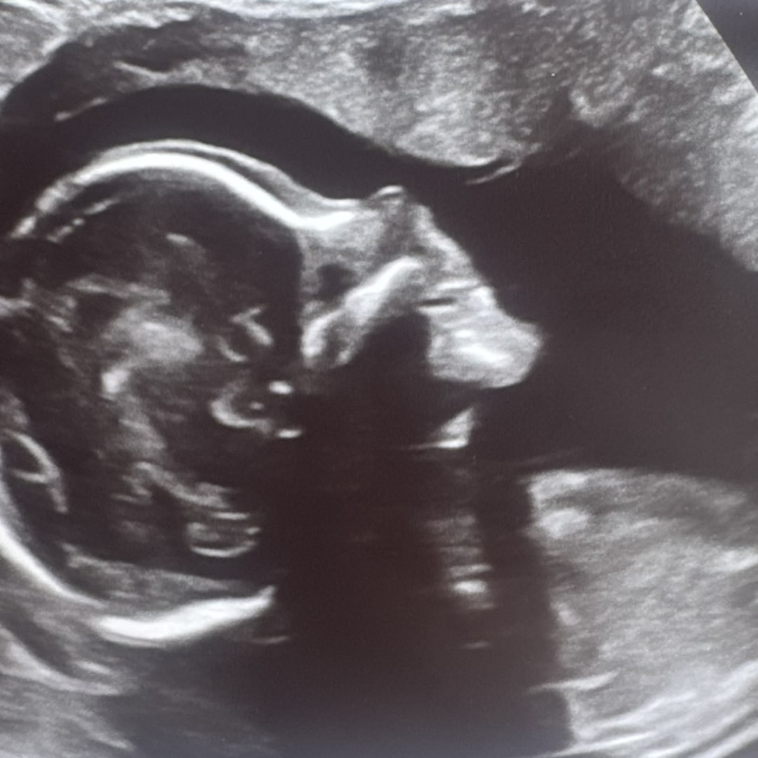 Photo shared by Gabrielle for their Babylist baby registry.