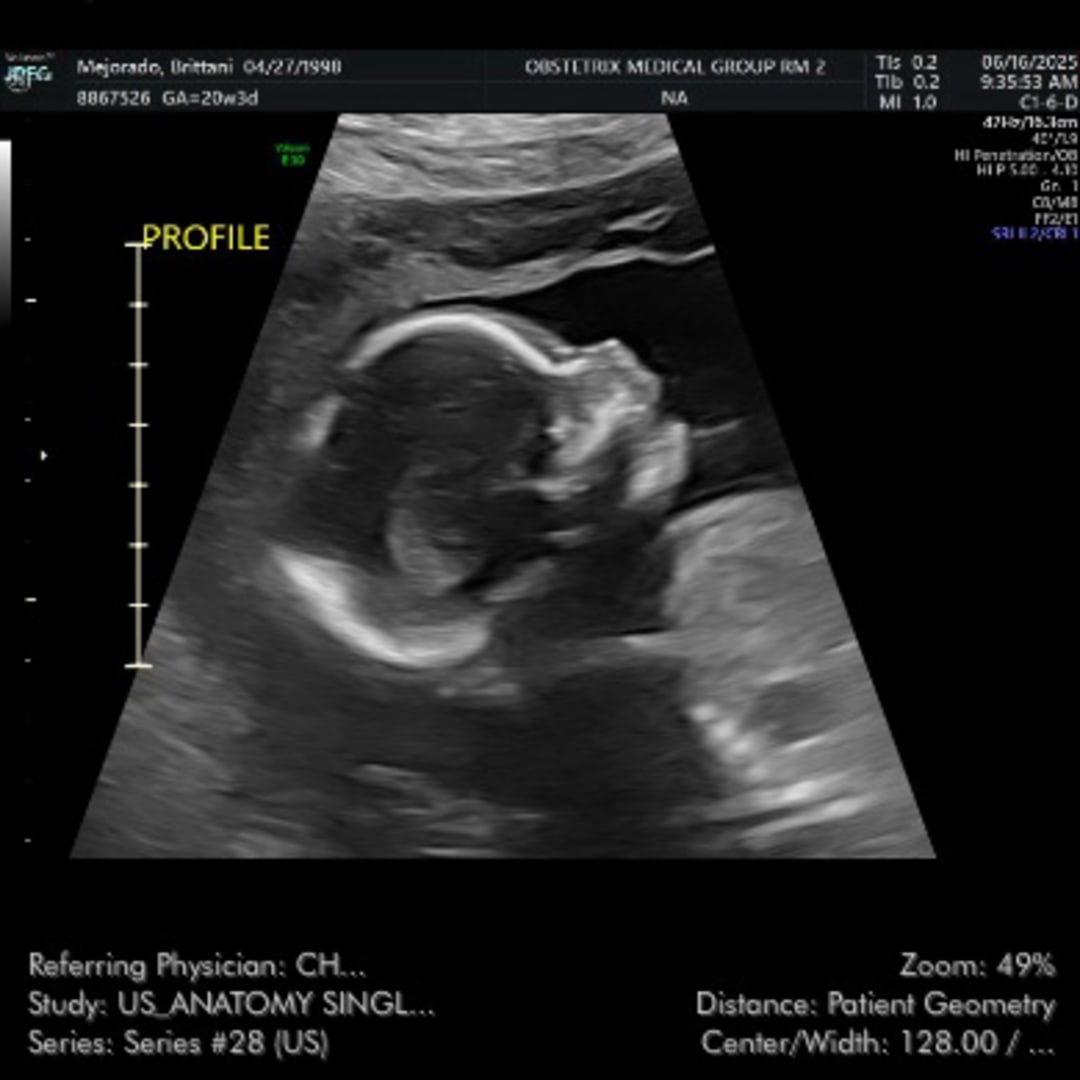 Photo shared by Brittani Arianna for their Babylist baby registry.