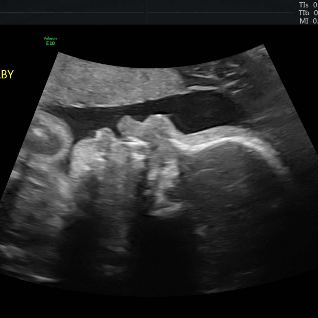 Photo shared by Christi for their Babylist baby registry.