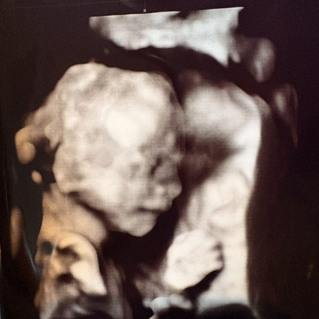 Photo shared by Christa for their Babylist baby registry.