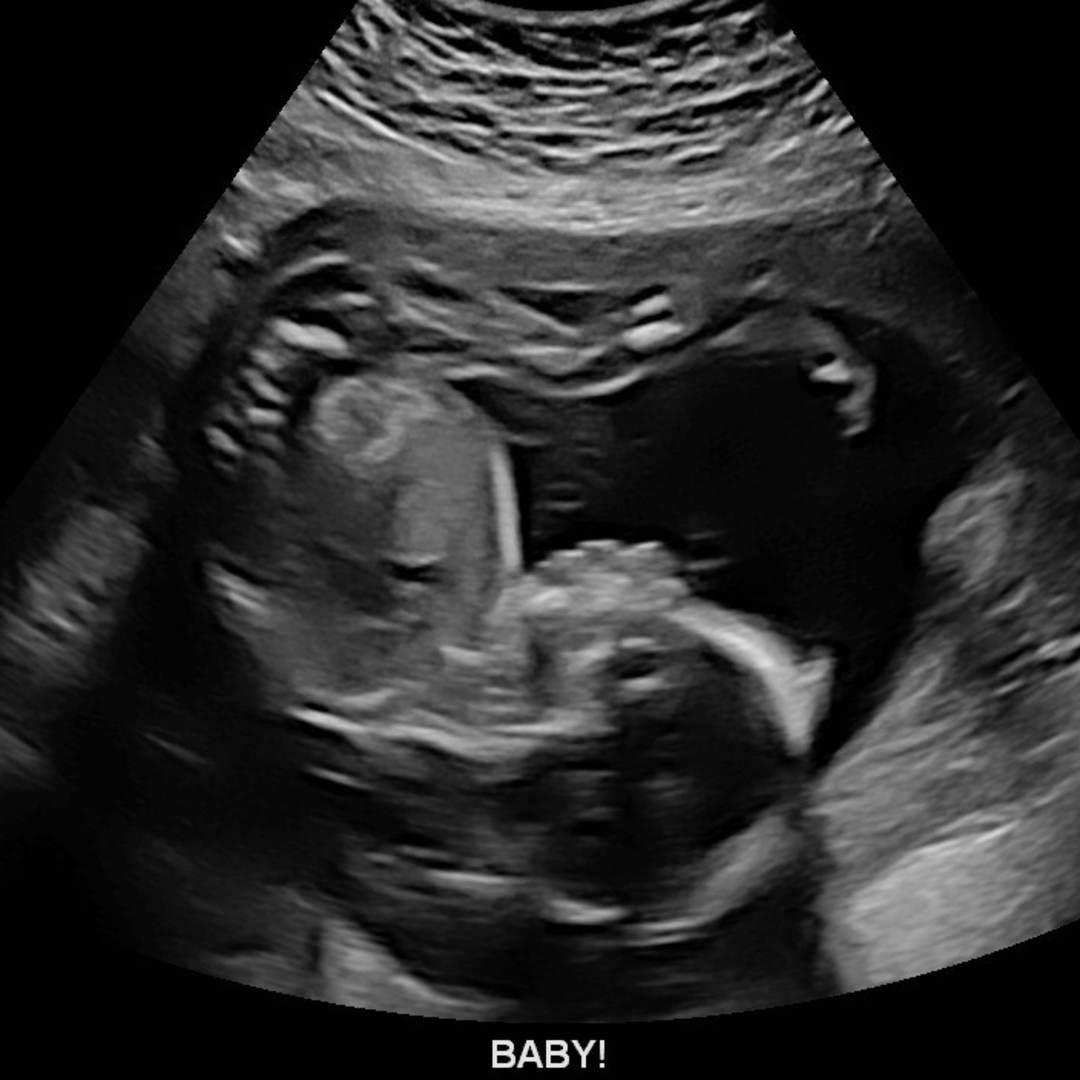 Photo shared by Jewel for their Babylist baby registry.