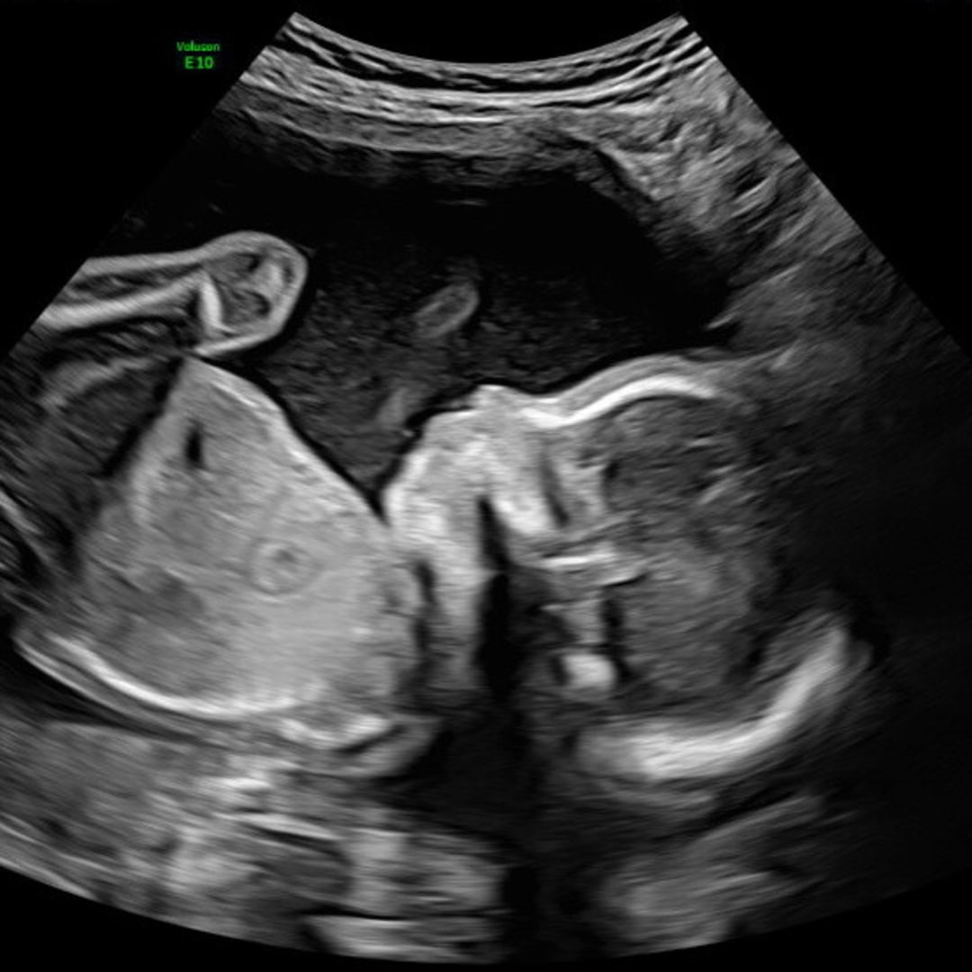 Photo shared by Jesslyn for their Babylist baby registry.