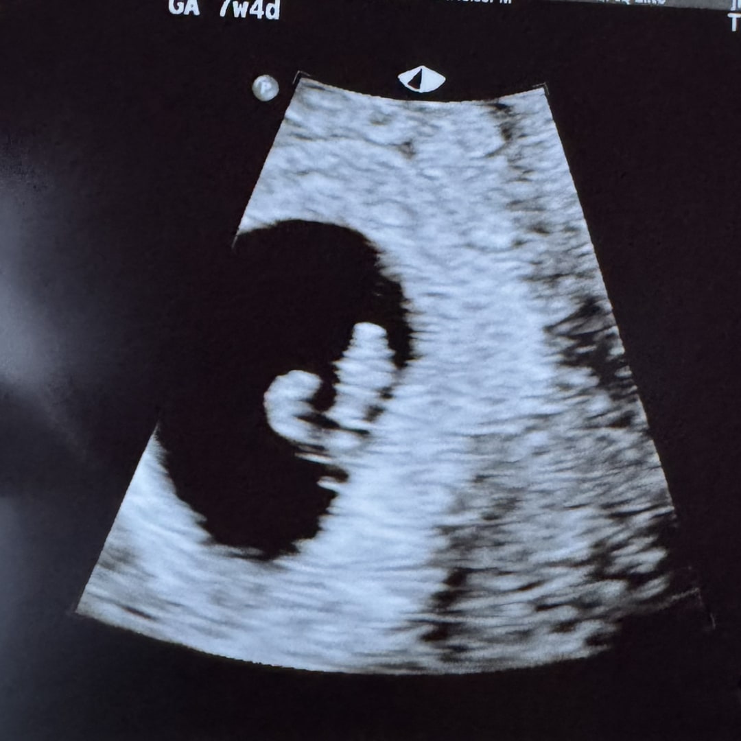 Photo shared by Jordan for their Babylist baby registry.