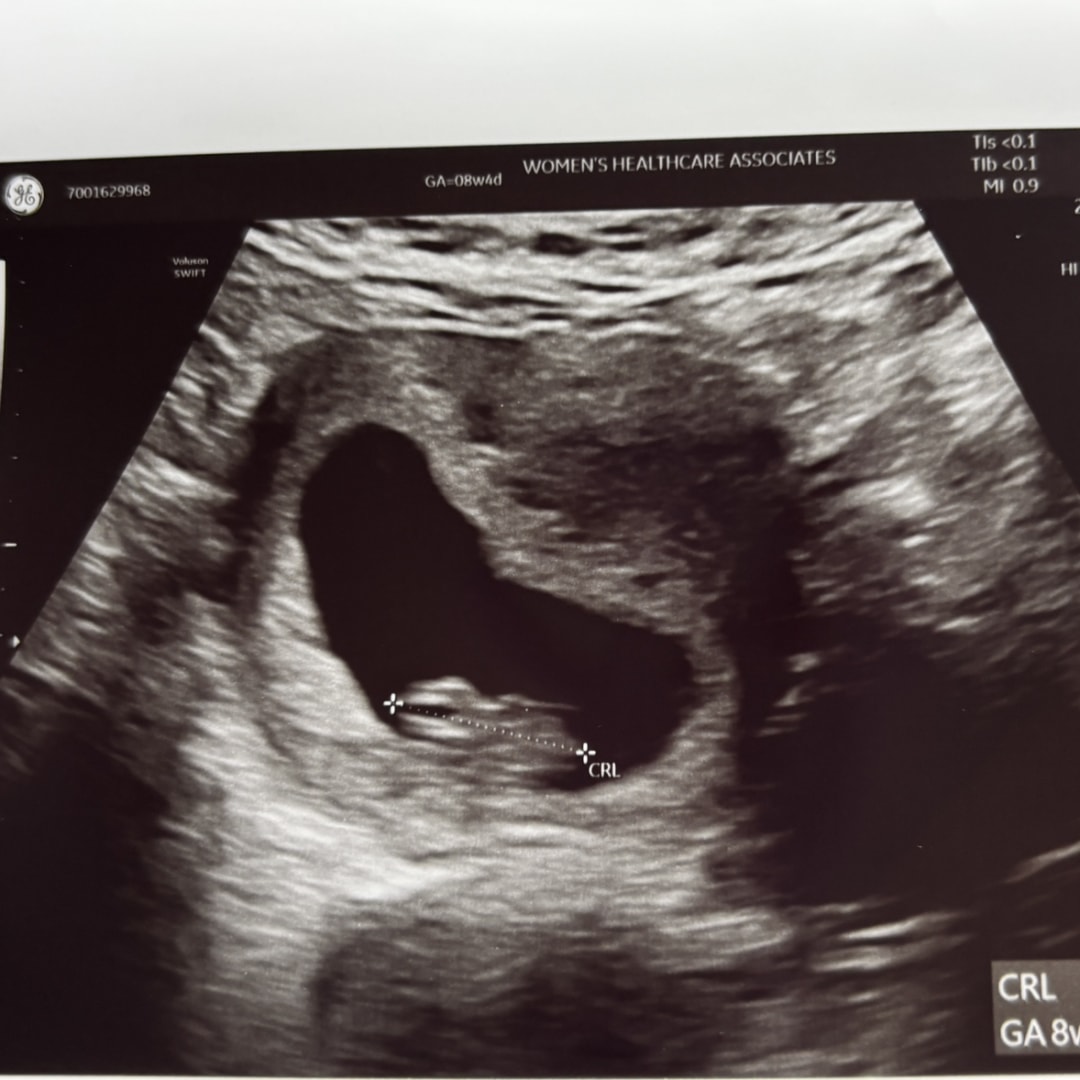 Photo shared by Olivia for their Babylist baby registry.