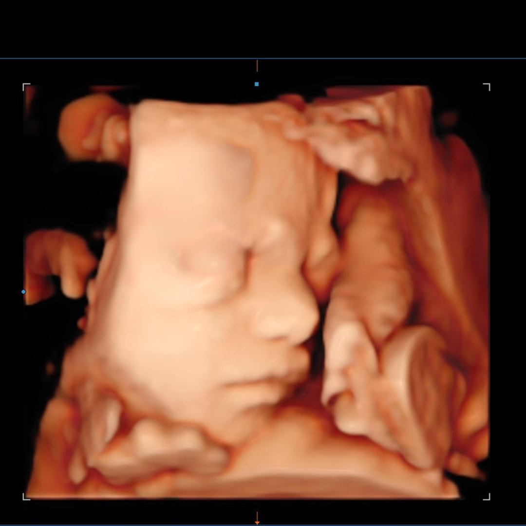 Photo shared by Haley for their Babylist baby registry.