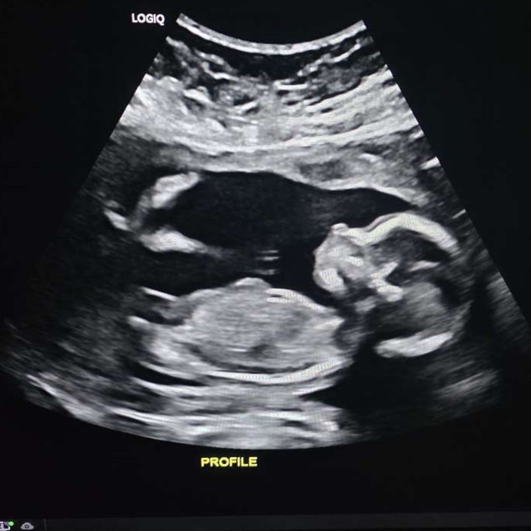 Photo shared by Nancy for their Babylist baby registry.