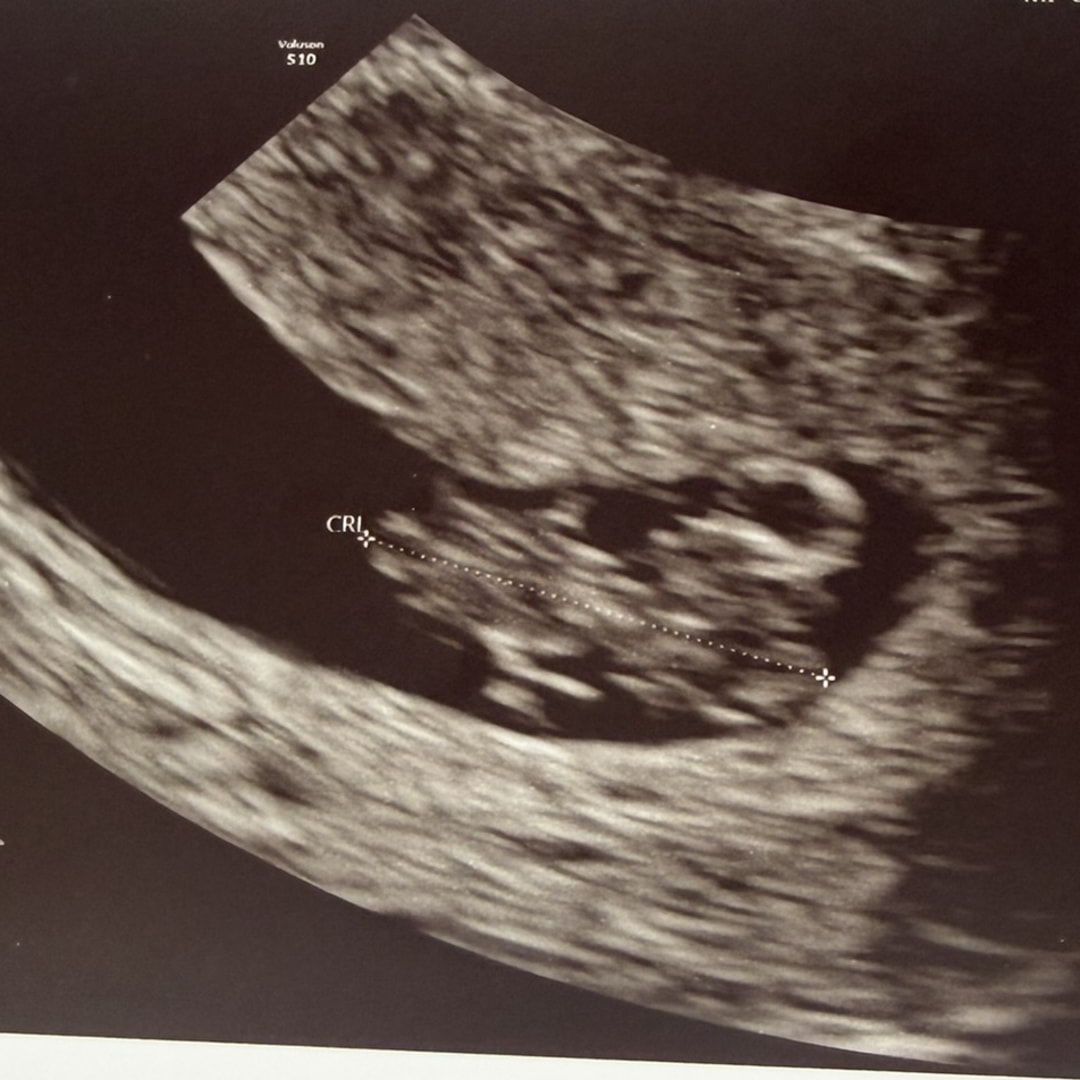 Photo shared by Angela for their Babylist baby registry.
