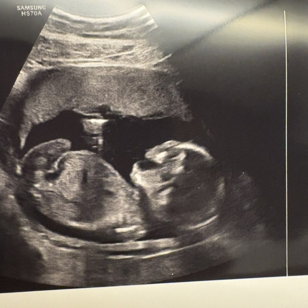 Photo shared by Carolyn for their Babylist baby registry.