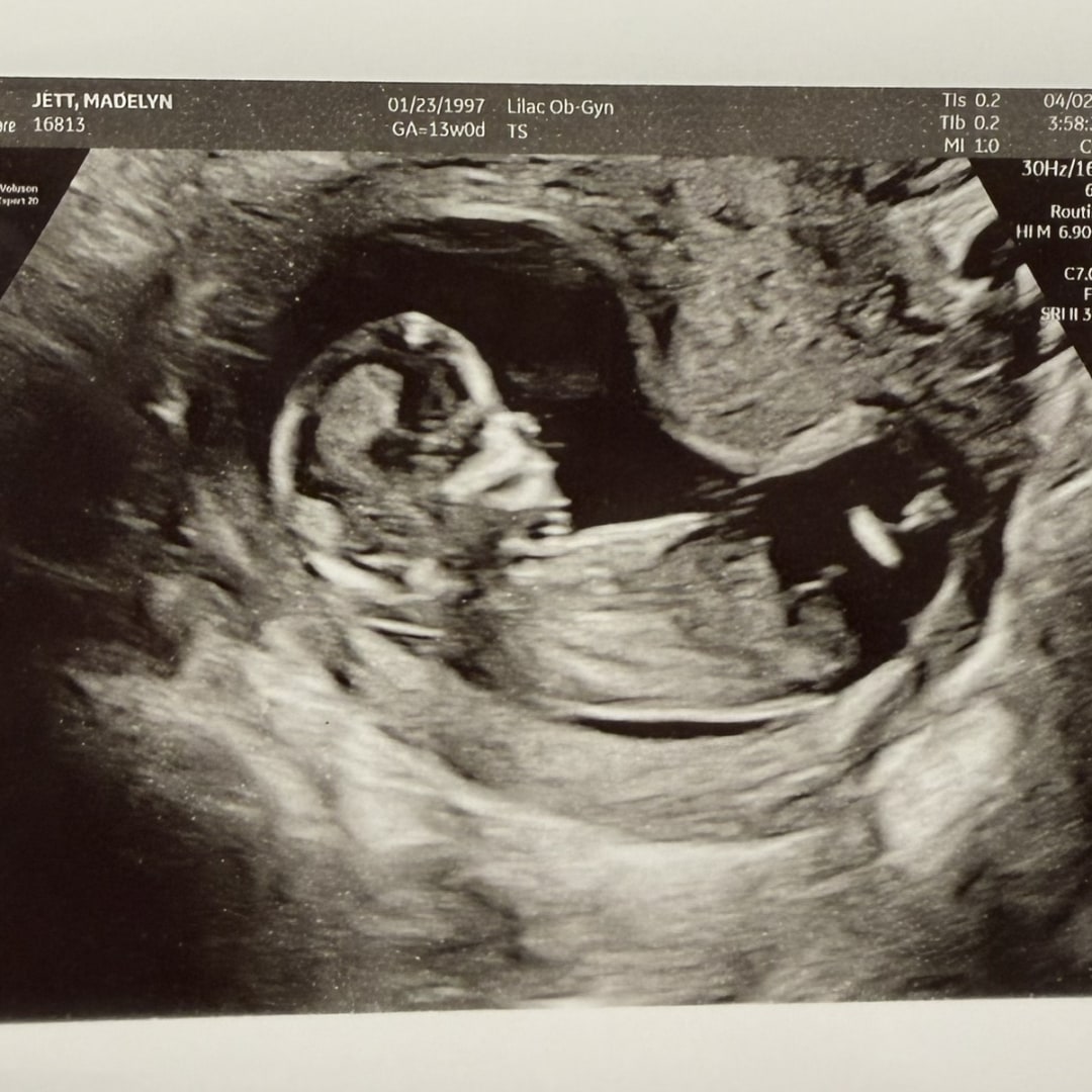 Photo shared by Madelyn for their Babylist baby registry.