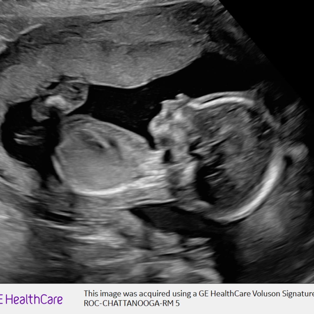 Photo shared by Emily for their Babylist baby registry.