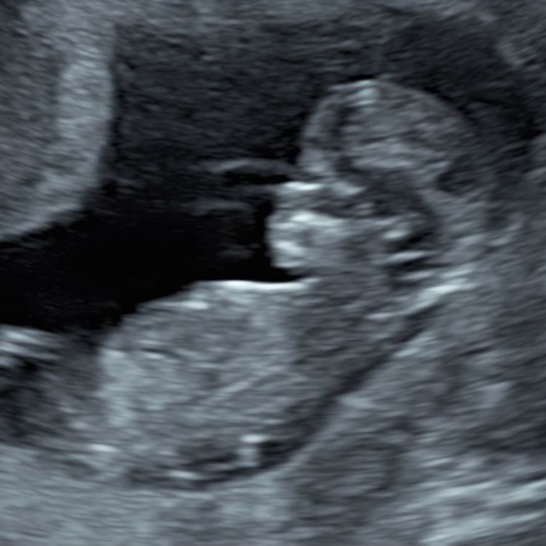 Photo shared by Karlee for their Babylist baby registry.