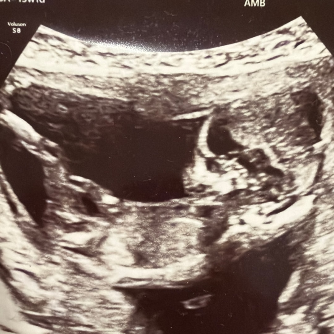 Photo shared by Melanie for their Babylist baby registry.