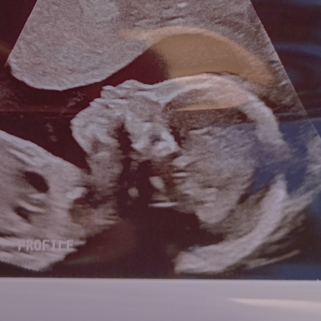 Photo shared by Ashley for their Babylist baby registry.