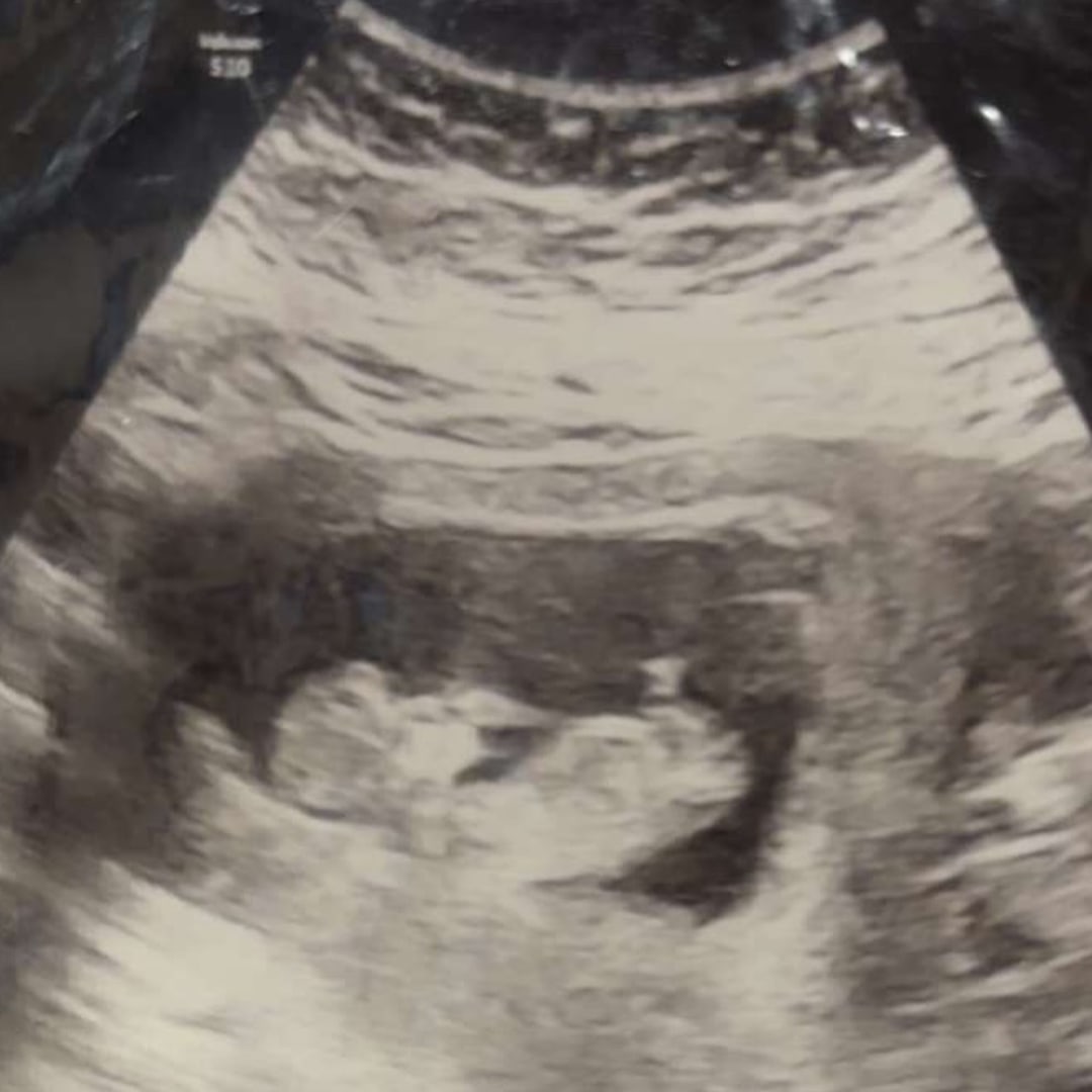 Photo shared by Brittany for their Babylist baby registry.