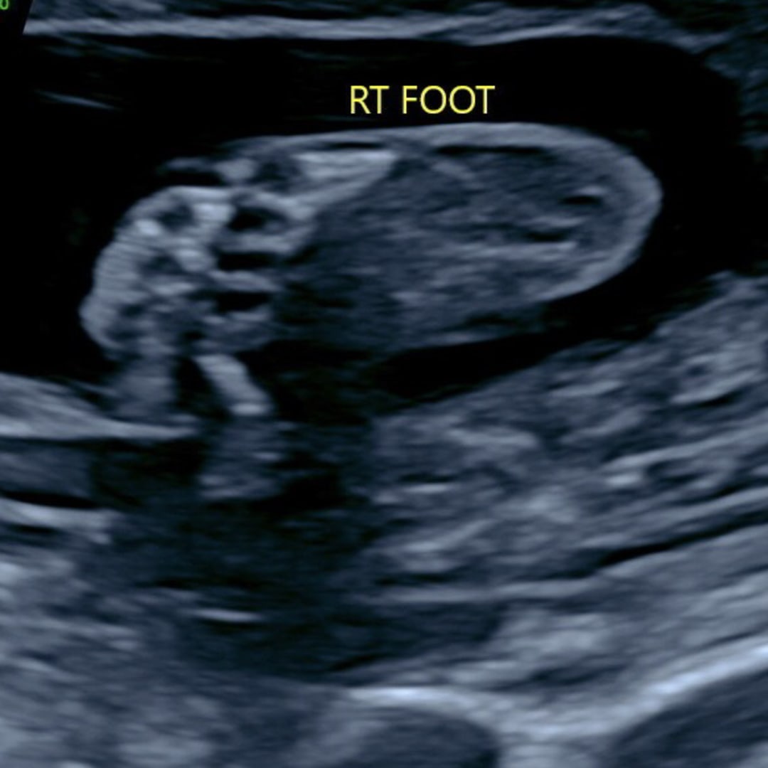 Photo shared by Ashby for their Babylist baby registry.