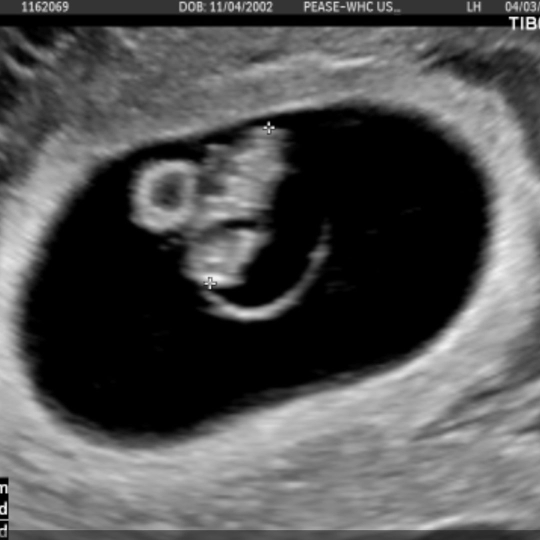 Photo shared by Kendra for their Babylist baby registry.