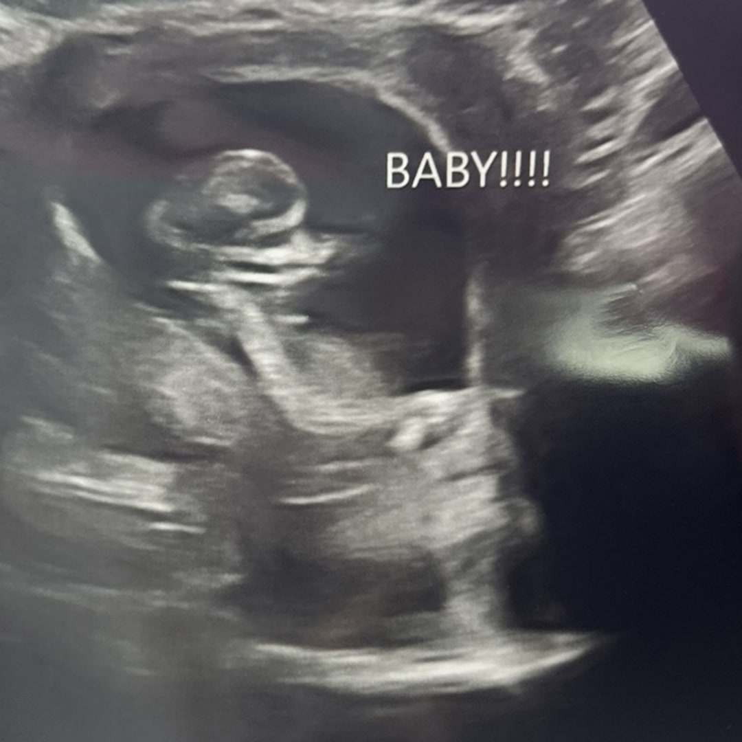 Photo shared by Bailey for their Babylist baby registry.