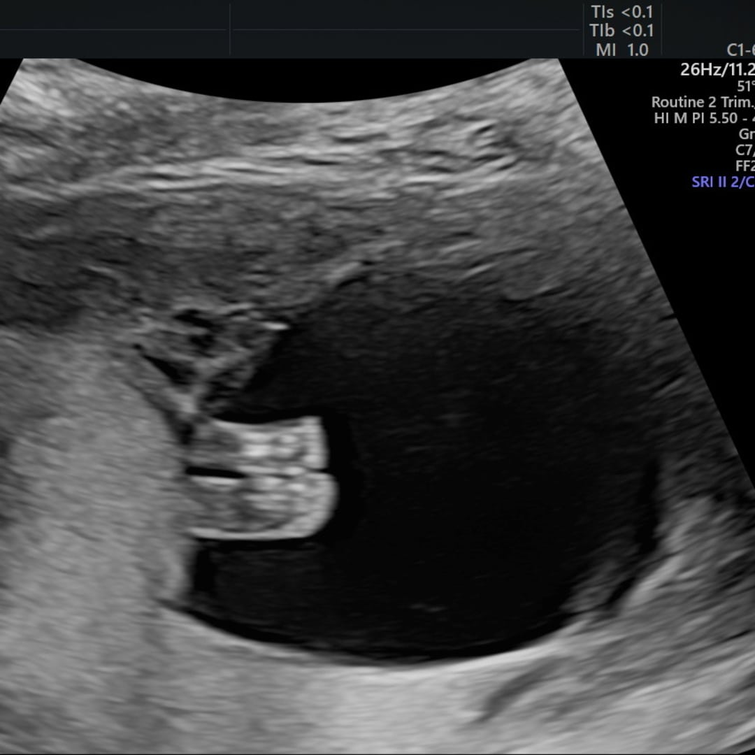 Photo shared by Pegah and Matthew for their Babylist baby registry.