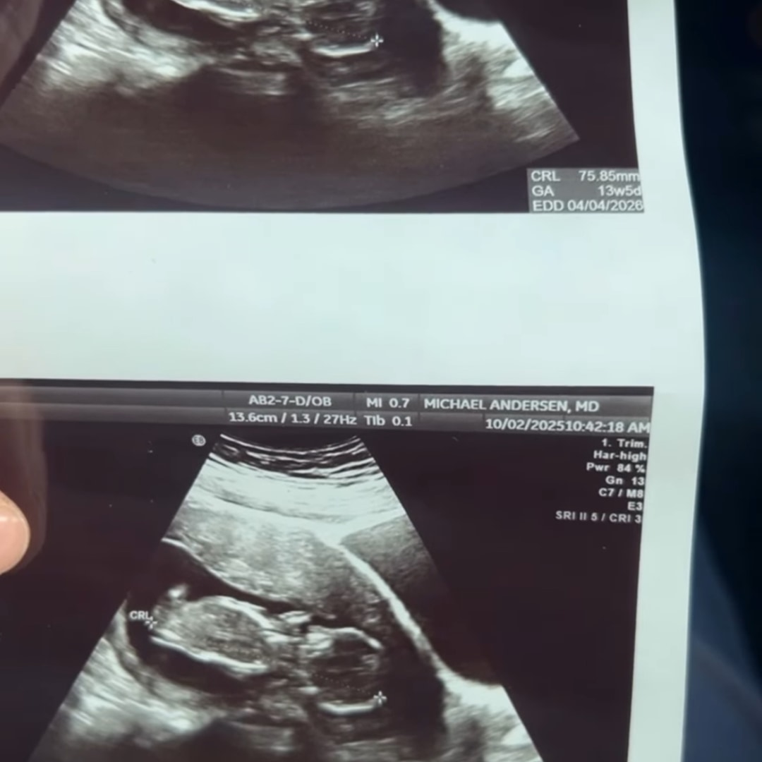 Photo shared by Ayionna for their Babylist baby registry.