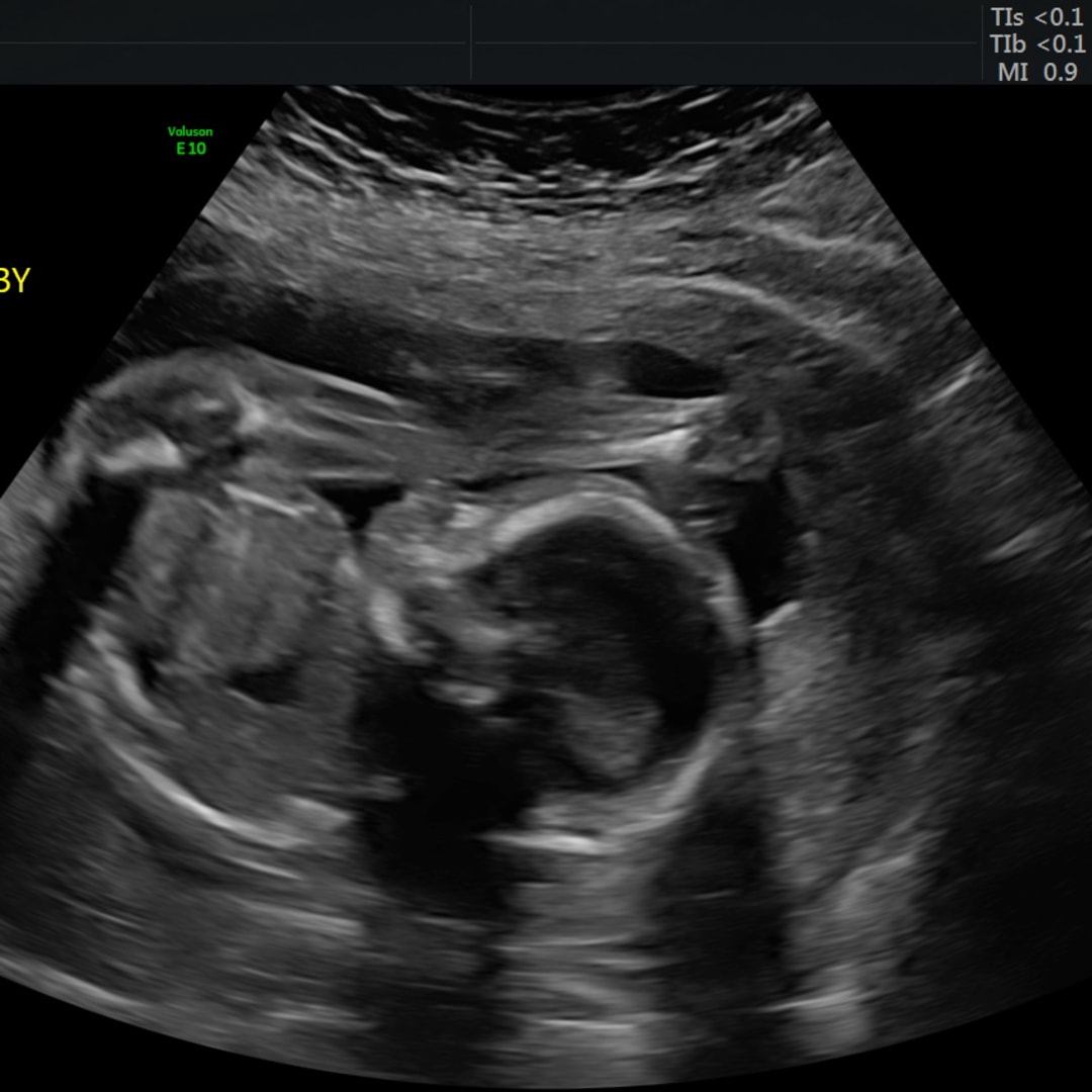 Photo shared by Destany for their Babylist baby registry.