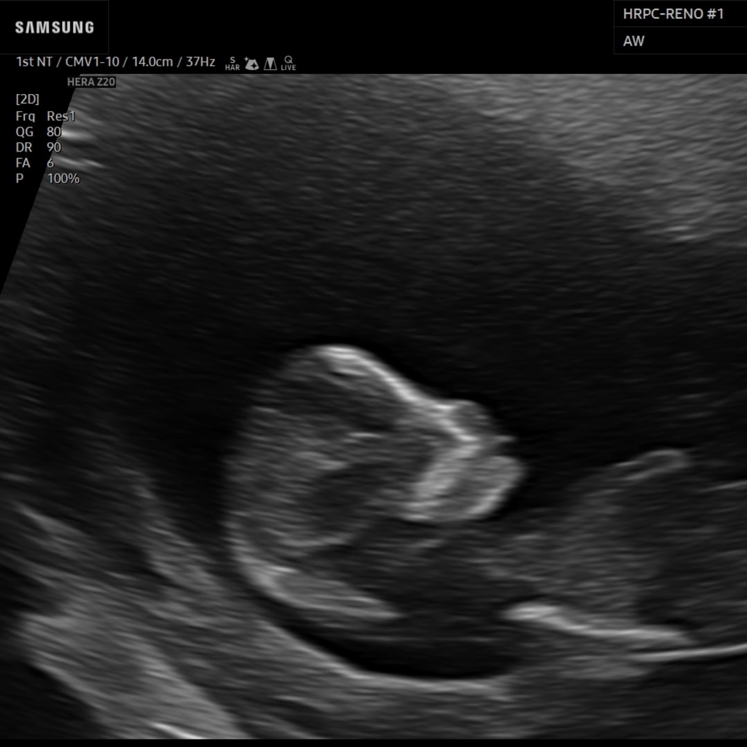 Photo shared by Lexi for their Babylist baby registry.