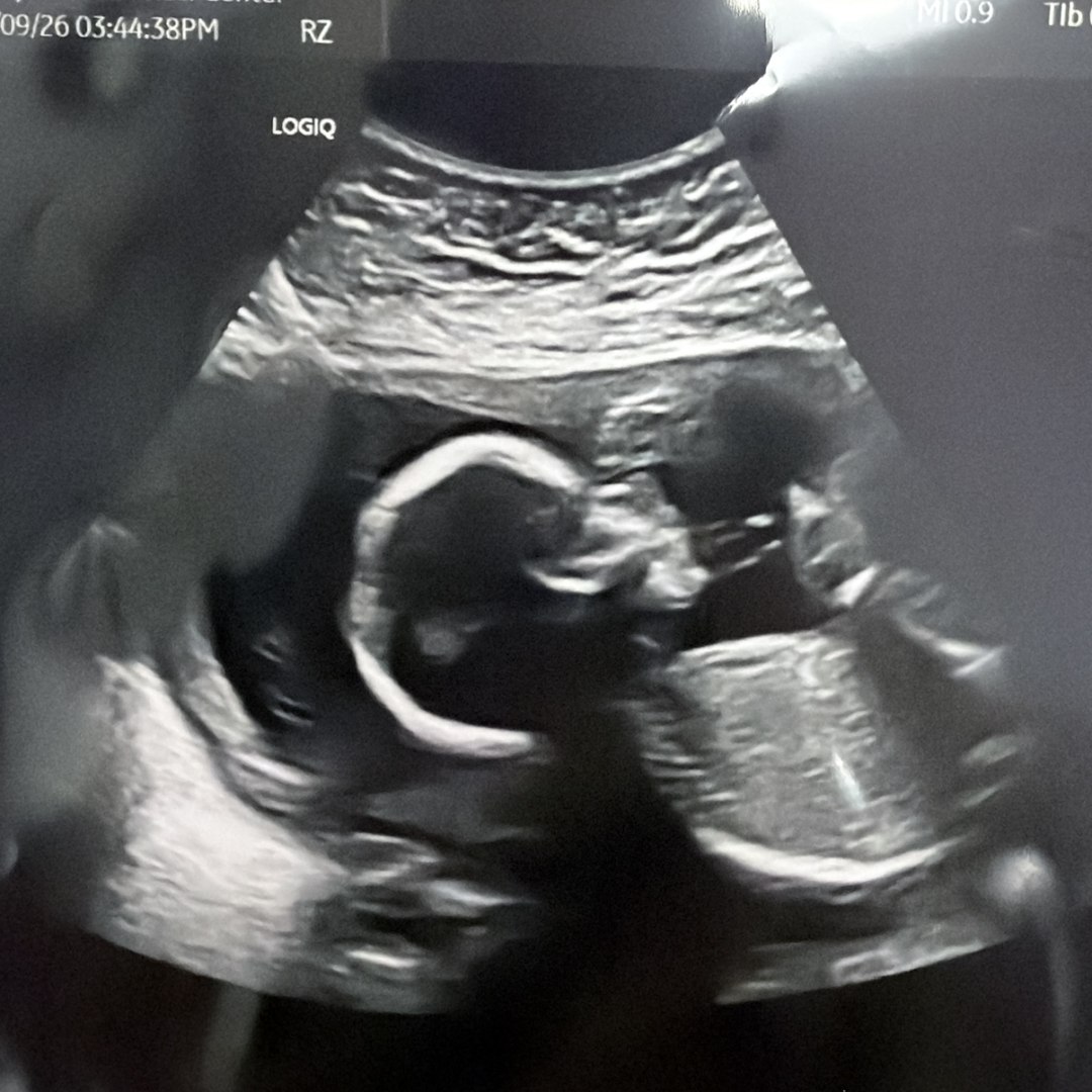 Photo shared by Tori for their Babylist baby registry.