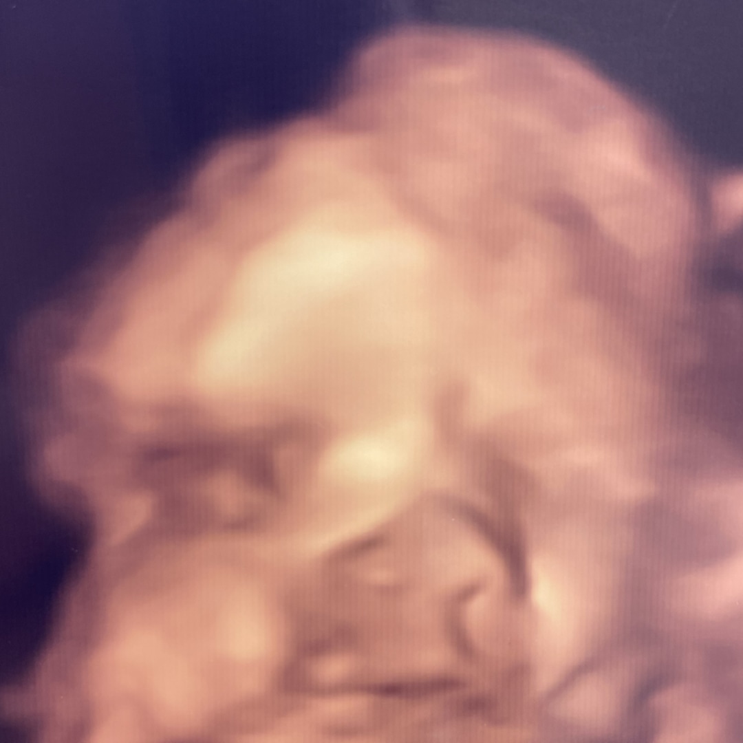 Photo shared by Tara for their Babylist baby registry.