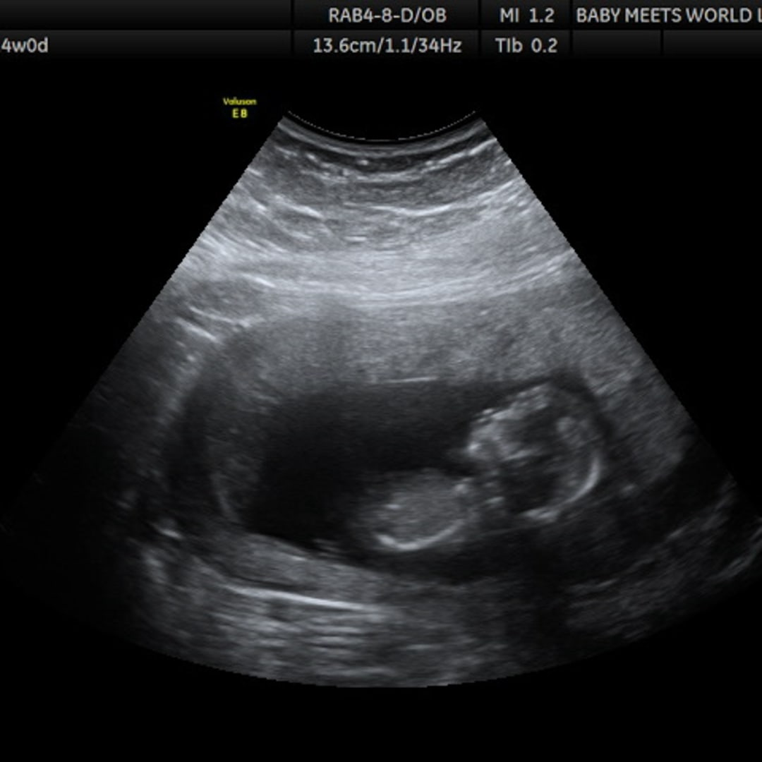 Photo shared by Abigail for their Babylist baby registry.