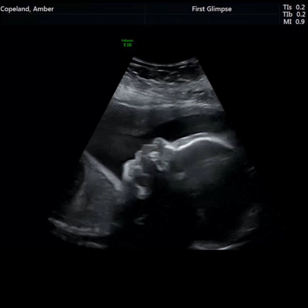 Photo shared by Amber for their Babylist baby registry.