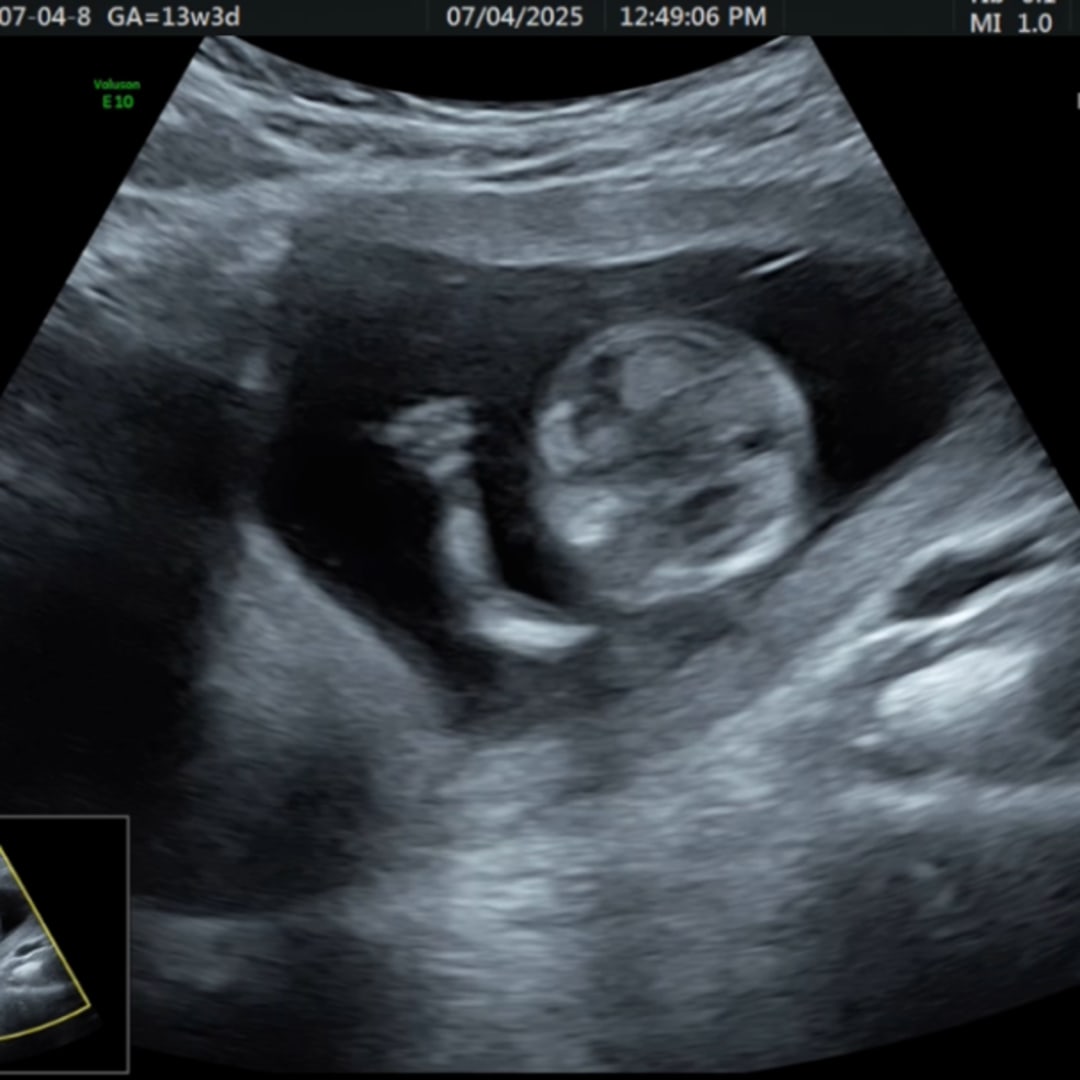 Photo shared by Estefania for their Babylist baby registry.